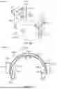 Fig. 84 - SYSTEM AND METHOD FOR CRIMPING AND LOADING A PROSTHETIC HEART VALVE