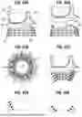 Fig. 28 - SURGICAL HEART VALVES