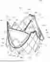 Fig. 01 - HEART VALVE PROSTHESIS