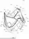 Fig. 03 - HEART VALVE PROSTHESIS