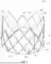 Fig. 07 - HEART VALVE PROSTHESIS