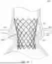 Fig. 08 - HEART VALVE PROSTHESIS