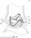 Fig. 09 - HEART VALVE PROSTHESIS