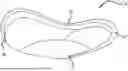 Fig. 01 - Annuloplasty Ring For Receiving A Replacement Valve
