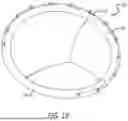 Fig. 07 - Annuloplasty Ring For Receiving A Replacement Valve