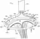Fig. 01 - TRANSCATHETER ANNULOPLASTY LOCKING SYSTEMS, DEVICES AND METHODS