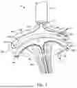 Fig. 02 - TRANSCATHETER ANNULOPLASTY LOCKING SYSTEMS, DEVICES AND METHODS