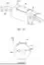 Fig. 07 - TRANSCATHETER ANNULOPLASTY LOCKING SYSTEMS, DEVICES AND METHODS