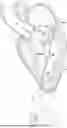 Fig. 01 - METHODS AND DEVICES FOR HEART VALVE REPAIR