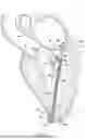 Fig. 02 - METHODS AND DEVICES FOR HEART VALVE REPAIR
