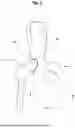 Fig. 02 - BUFFER FOR FEMORAL HEAD AND NECK EXCISION