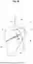 Fig. 05 - BUFFER FOR FEMORAL HEAD AND NECK EXCISION