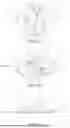 Fig. 02 - KNEE ARTHROPLASTY DEVICES, SYSTEMS, AND METHODS