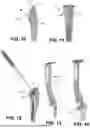 Fig. 07 - SYSTEMS FOR REVERSE SHOULDER IMPLANTS