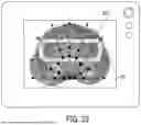 Fig. 28 - Method and Apparatus for Reducing Human Vertebral Body Subsidence Using Variable Surface Area Interbody Cages Correlated to Localized Bone Density Measurements
