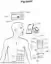 Fig. 90 - STRETCHING DEVICE