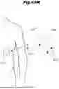 Fig. 96 - STRETCHING DEVICE