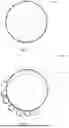 Fig. 03 - IMPLANT, MORE PARTICULARLY STENT, AND METHOD OF PRODUCTION