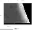 Fig. 04 - IMPLANT, MORE PARTICULARLY STENT, AND METHOD OF PRODUCTION