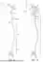 Fig. 02 - ORTHOPEDIC DEVICE