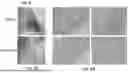 Fig. 19 - COMPOSITIONS AND METHODS FOR THE TREATMENT AND PREVENTION OF VASCULAR MALFORMATIONS