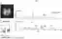 Fig. 04 - NAD-AUGMENTATION THERAPY FOR PARKINSON'S DISEASE