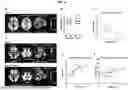 Fig. 05 - NAD-AUGMENTATION THERAPY FOR PARKINSON'S DISEASE
