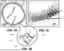 Fig. 02 - METHOD FOR MODULATING ENDOTHELIAL GLYCOCALYX STRUCTURE