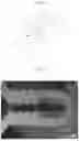 Fig. 02 - THERMOPLASTIC RESIN PELLETS AND METHOD FOR MANUFACTURING THERMOPLASTIC RESIN PELLETS
