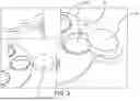 Fig. 04 - Plastic Recycling Furnace System 