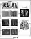 Fig. 04 - SYSTEMS AND METHODS FOR DETECTING AND CHARACTERIZING COVID-19