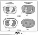 Fig. 05 - SYSTEMS AND METHODS FOR DETECTING AND CHARACTERIZING COVID-19