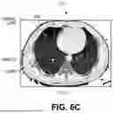 Fig. 09 - SYSTEMS AND METHODS FOR DETECTING AND CHARACTERIZING COVID-19