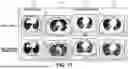 Fig. 14 - SYSTEMS AND METHODS FOR DETECTING AND CHARACTERIZING COVID-19