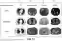 Fig. 16 - SYSTEMS AND METHODS FOR DETECTING AND CHARACTERIZING COVID-19