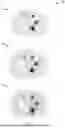 Fig. 08 - METHODS AND SYSTEMS FOR SCATTER AND TAILING CORRECTION