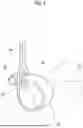 Fig. 05 - PROBE CABLE HOOK AND CABLE HOLDING STRUCTURE