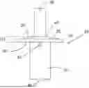 Fig. 01 - TISSUE SUSPENSION IMPLANT
