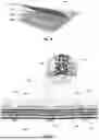 Fig. 04 - NONUNIFORM EMBROIDERED SOFT TISSUE IMPLANT STRUCTURE