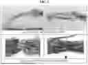 Fig. 03 - APPARATUS, SYSTEM, AND METHOD OF DETERMINING ELECTRICAL MELTING TRACES BY DIRECT CURRENT AND ALTERNATING CURRENT IN WIRES BASED ON DEEP LEARINING