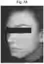 Fig. 07 - COMPOSITIONS USEFUL FOR IMPROVING THE APPEARANCE OF SKIN AND METHODS OF USE THEREOF