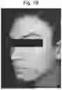 Fig. 08 - COMPOSITIONS USEFUL FOR IMPROVING THE APPEARANCE OF SKIN AND METHODS OF USE THEREOF
