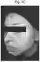 Fig. 09 - COMPOSITIONS USEFUL FOR IMPROVING THE APPEARANCE OF SKIN AND METHODS OF USE THEREOF
