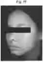 Fig. 12 - COMPOSITIONS USEFUL FOR IMPROVING THE APPEARANCE OF SKIN AND METHODS OF USE THEREOF