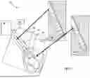 Fig. 03 - METHODS FOR VECTOR-BASED TARGETING OF THE HUMAN CENTRAL THALAMUS TO GUIDE DEEP BRAIN STIMULATION AND DEVICES THEREFOR