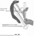 Fig. 05 - METHODS FOR VECTOR-BASED TARGETING OF THE HUMAN CENTRAL THALAMUS TO GUIDE DEEP BRAIN STIMULATION AND DEVICES THEREFOR