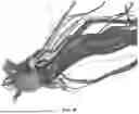 Fig. 12 - METHODS FOR VECTOR-BASED TARGETING OF THE HUMAN CENTRAL THALAMUS TO GUIDE DEEP BRAIN STIMULATION AND DEVICES THEREFOR