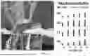 Fig. 15 - METHODS FOR VECTOR-BASED TARGETING OF THE HUMAN CENTRAL THALAMUS TO GUIDE DEEP BRAIN STIMULATION AND DEVICES THEREFOR
