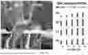 Fig. 16 - METHODS FOR VECTOR-BASED TARGETING OF THE HUMAN CENTRAL THALAMUS TO GUIDE DEEP BRAIN STIMULATION AND DEVICES THEREFOR