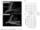 Fig. 20 - METHODS FOR VECTOR-BASED TARGETING OF THE HUMAN CENTRAL THALAMUS TO GUIDE DEEP BRAIN STIMULATION AND DEVICES THEREFOR